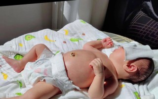 新生儿黄疸晒太阳，晒多久、晒哪里、注意啥？科学退黄有讲究！