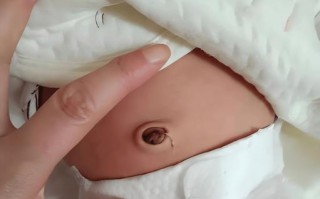 新生儿脐带不小心扯掉后会不会感染？正确处理方法是什么？