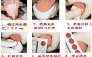 新生儿足跟血检测真的必须做吗？不做会有哪些健康风险或潜在问题？