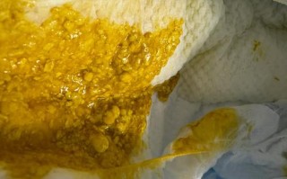 新生儿频繁拉一点点屎是正常生理现象还是消化异常信号？