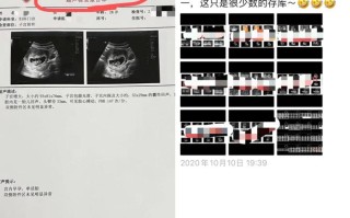 孕期B超检查能发现哪些关键问题？胎儿健康与发育异常如何通过B超及早识别？