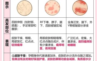 孕期皮肤痒是怎么回事