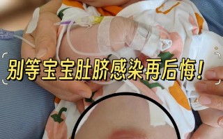新生儿肚脐有点化脓了，家长该怎么办？需要马上去医院吗？