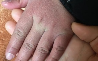 新生儿手脚冰凉是正常现象还是健康预警？体温调节机制有何特别之处？