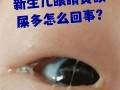 新生儿眼睛眼屎多流泪