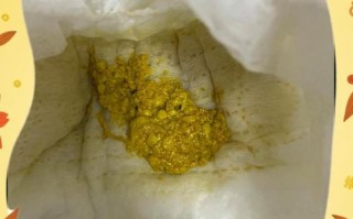 新生儿拉黄屎带奶瓣正常吗？