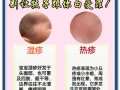 新生儿湿疹怎么办？
