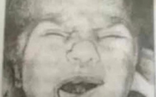 新生儿哭时嘴巴歪是正常现象还是异常信号？需警惕哪些潜在问题？