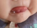 新生儿宝宝总爱含舌头，是正常发育还是有健康隐患？