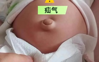 新生儿肚脐眼到底能不能碰水？日常护理该注意哪些细节？