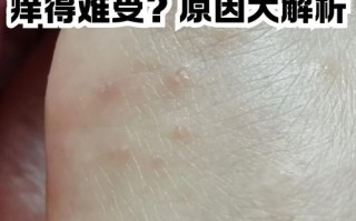 怀孕期间脚丫痒得难受，到底是什么原因引起的？