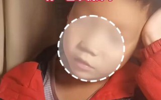 儿童不自主眨眼、嘴抽是习惯还是疾病？家长该如何应对？