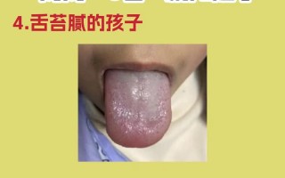 新生儿舌头抖是正常生理现象还是疾病信号？需关注哪些伴随症状？