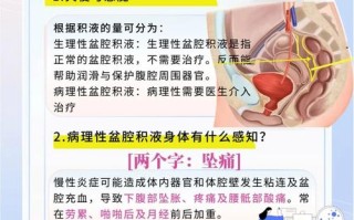孕期盆腔积液会怎么样？对胎儿有影响吗？需要治疗吗？