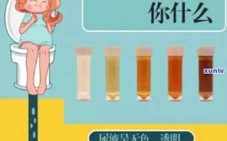 儿童尿是茶色怎么回事
