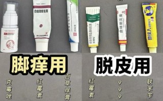 孕期误用脚气药膏会影响胎儿健康吗？如何正确处理用药风险？