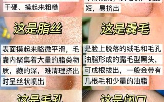 怀孕期间祛黑头有风险吗？哪些方法既安全又有效？