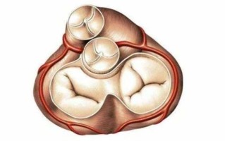 新生儿三尖瓣少量反流需要治疗吗？会影响生长发育吗？