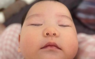 新生儿鼻子大是正常发育现象吗？会随年龄增长变小吗？