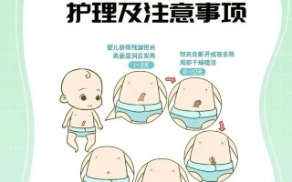 新生儿掉肚脐后怎么护理？日常清洁、消毒、观察红肿有讲究吗？