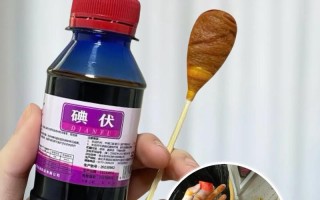 新生儿肚脐擦碘伏要持续多久才算正确？擦多久能避免感染？