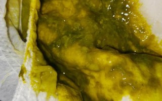 新生儿拉屎有奶瓣还发绿，是消化不良还是需要就医？