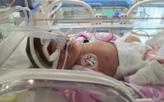 新生儿败血症治疗的最佳时间窗口究竟有多关键？错过会有哪些不可逆影响？