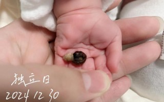 新生儿脐带脱落 流水