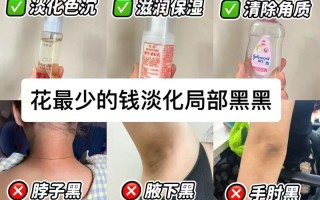 孕期黑色素沉淀会随时间自然消退吗？一般需要多久才能恢复孕前肤色？