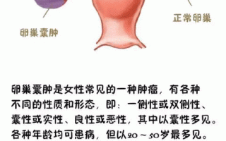 孕期卵巢囊肿破裂该怎么办？对胎儿和孕妇有什么危险？