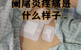 孕期阑尾炎发作时，身体会有哪些异常信号与普通阑尾炎有何不同？