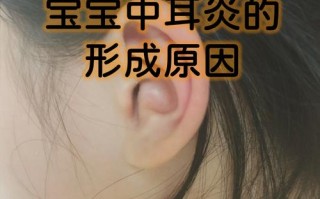 儿童中耳炎的常见症状有哪些？家长该如何早期识别与应对？