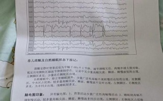 儿童脑电图异常严重吗？是否需要立即就医？会对大脑发育有影响吗？