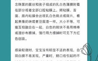新生儿鹅口疮反复发作怎么办？日常护理有哪些关键点？