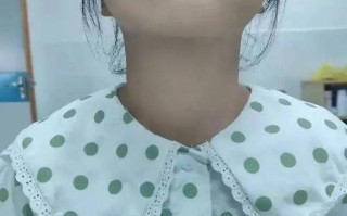 七岁儿童甲减早期症状有哪些？家长该如何早期识别与干预？