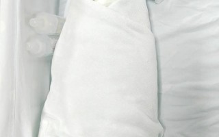 新生儿做磁共振检查存在哪些潜在危害？