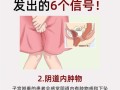 孕期遭遇子宫下垂，产后究竟能否自行恢复？