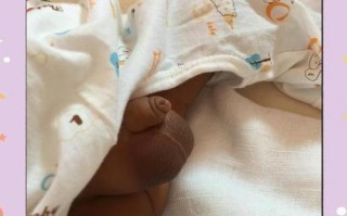 新生儿蛋蛋一大一小是正常现象还是疾病信号？需要就医检查吗？