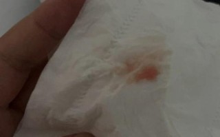 孕期胎盘前置流血了怎么办？需要立刻去医院保胎吗？