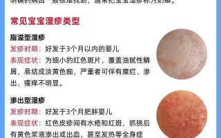 儿童皮炎湿疹反复发作，到底该如何科学治疗才能根治？