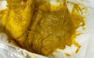 新生儿大便黏糊糊的，是消化不良还是正常现象？