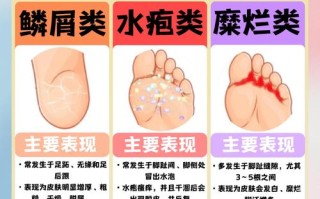 儿童脚脱皮是缺乏营养还是皮肤疾病？家长该如何正确应对？