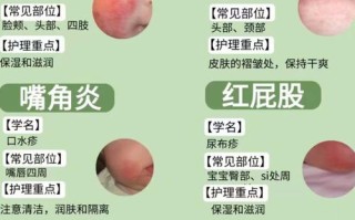 新生儿红屁股是正常现象还是护理不当？如何有效预防与护理？