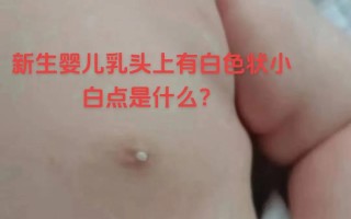新生儿乳头白点是何原因？
