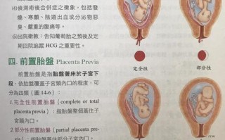 胎盘位置孕期会变吗？