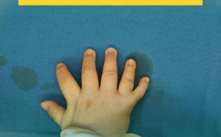 新生儿手指偏长是发育异常信号？还是健康优势体现？