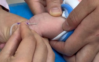 新生儿黄疸抽血怎么抽