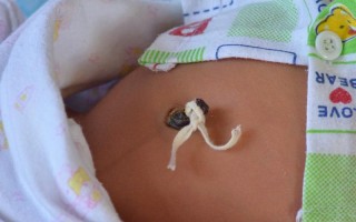 新生儿肚脐脱落后多久能碰水？