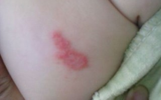 新生儿大腿摸到硬块是正常现象还是疾病信号？需要警惕哪些潜在问题？