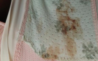 初孕小腹阵痛出血是先兆流产吗？需要立即就医吗？